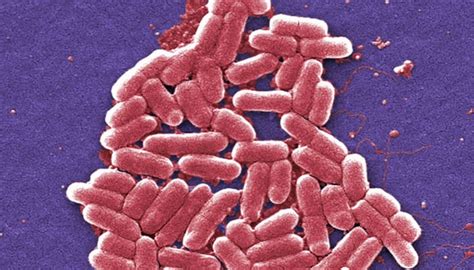 superbug ndm          dangerous health