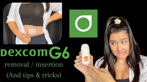 How To Change Your Dexcom G Sensor Tutorial Dexcom G Removal