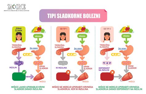 Ikonografika Tipi sladkorne bolezni Društvo za zdravje srca in