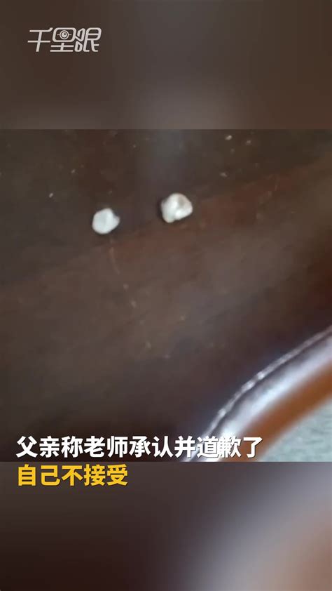 【湖南】网曝疑一小学女老师把学生的牙齿打掉两颗，父亲：老师承认并道歉了自己不接受，报警了后续会打官司维权