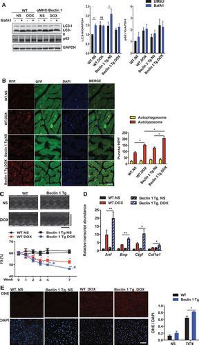 Doxorubicin Blocks Cardiomyocyte Autophagic Flux By Inhibiting Lysosome