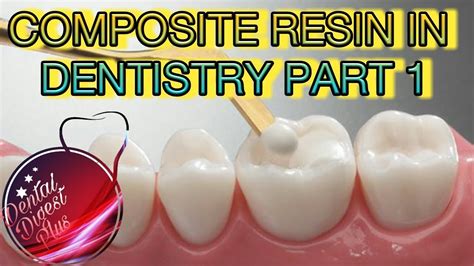 Composite Resin In Dentistry Part Youtube