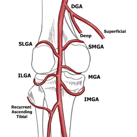 Schematic Of The Genicular Arteries Download Scientific Diagram