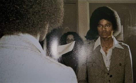 MJ and vitiligo - Michael Jackson Photo (11742943) - Fanpop