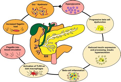 Gut Derived Bacterial Flagellin Induces Beta Cell Inflammation And