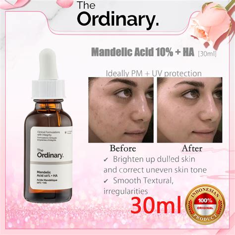 The Ordinary Mandelic Acid Ha Ml Dissolve The Skin Dulling Must