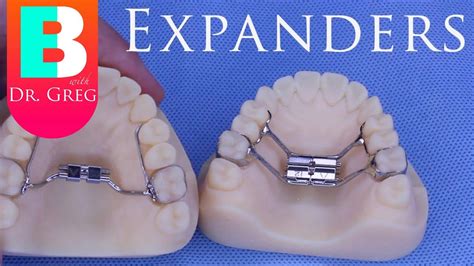 [braces Explained] Palatal Expanders Youtube