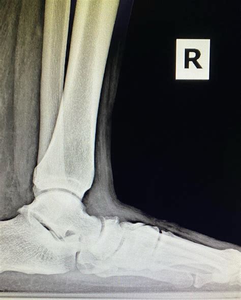 Capital Foot & Ankle Surgeons of Austin | Austin TX