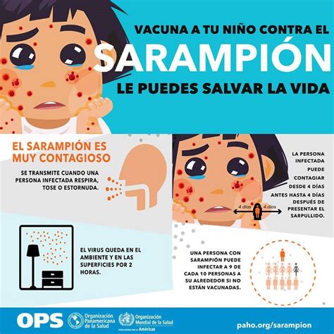 Atención existe alto riesgo de que el sarampión se reintroduzca al