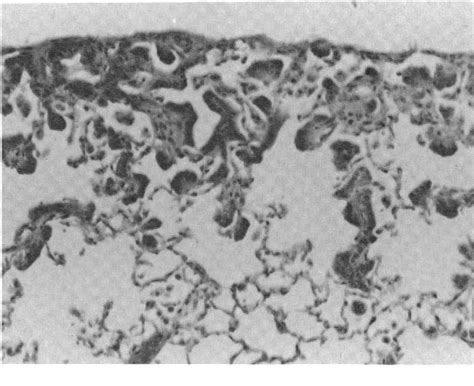 Figure 2 From Morphology Of Neoplastic Lesions Induced By 13 Butadiene In B6c3f1 Mice