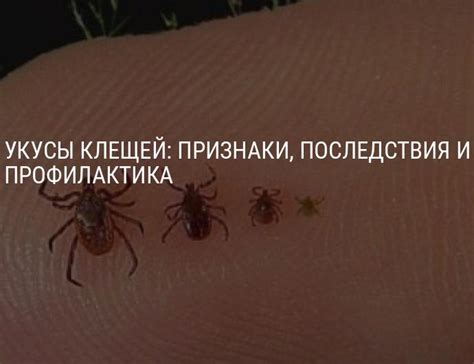 Укус клеща у человека: признаки, последствия, лечение укуса клеща у ...
