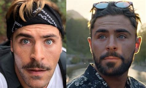 El Accidente Que Casi Mata A Zac Efron Y Cambió Su Rostro Repentinamente