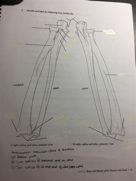 Radius Diagram Quizlet