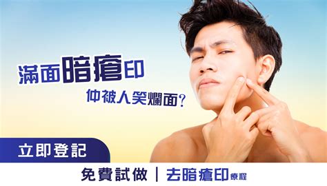 【暗瘡印教室】了解成因6招快速去暗瘡印方法 Perfect Men