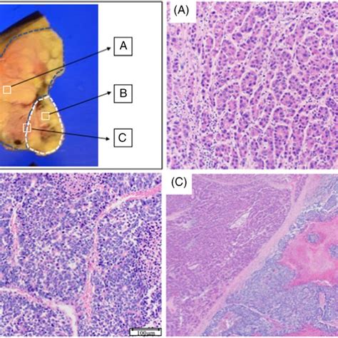 Findings Of Enhanced Abdominal Computed Tomography Ct And F‐18 Download Scientific Diagram