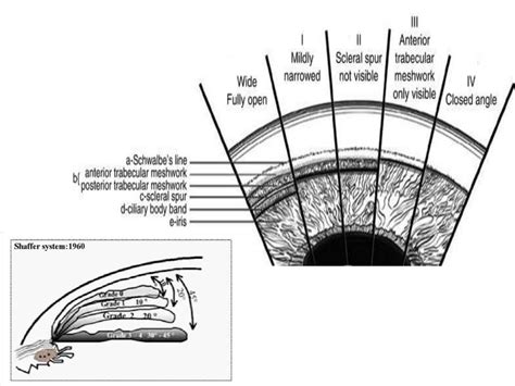 Anatomy of anterior chamber angle (1)