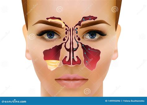 Sinusitis Illustrazione Nasale Di Infiammazione E Sana Del Seno Di