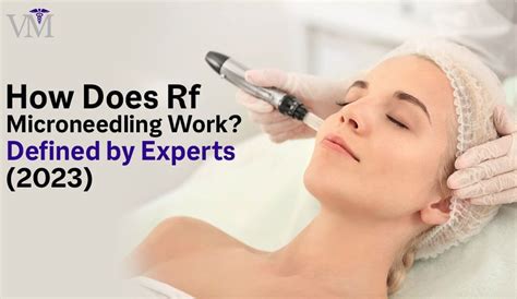 How Does Rf Microneedling Work Defined By Experts 2023 Valor Medical