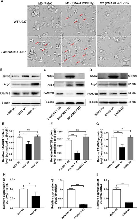 Fam76b Regulates Pi3kaktnf κb Mediated M1 Macrophage Polarization By