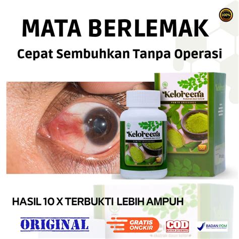 Jual Obat Mata Berlemak Herbal Keloreena Bisa Cod Shopee Indonesia