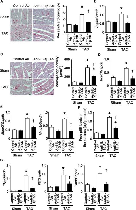 Il‐1β Neutralization Suppresses Angiogenesis Inflammatory Responses