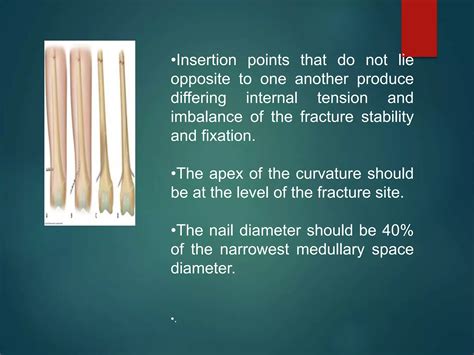 Intramedullary Nailing Ppt