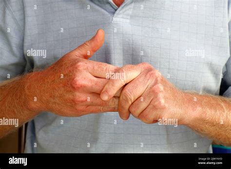 Close Up Of Mature Caucasian Males Left Hand Massaging The Fingers Of