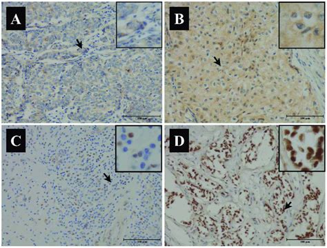 Representative Immunohistochemical Micrographs For The Low A C And Download Scientific