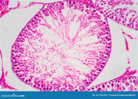 Sperma Umano Nella Morfologia Dei Testicoli Al Microscopio Fotografia