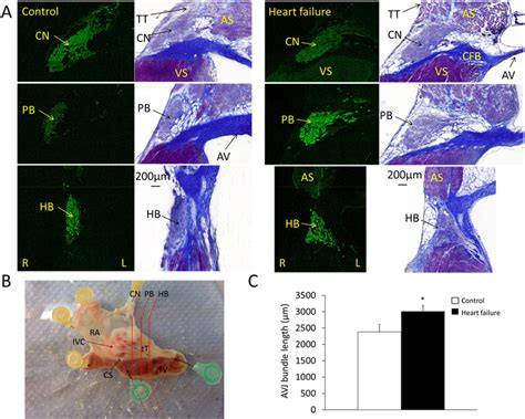 Histological Reconstruction Of The Avj A Representative Staining Of