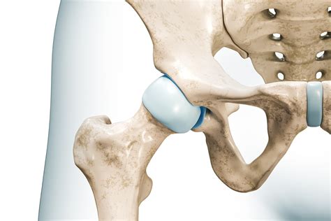 General Orthopedics - Gulf Coast Orthopedics