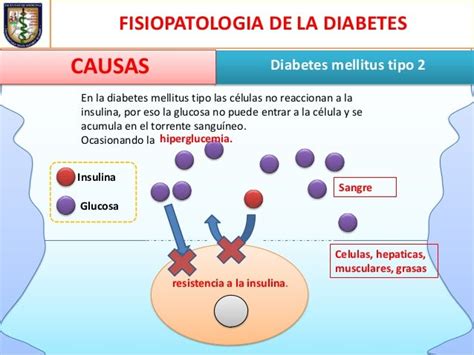 Fisiopatologia De La Diabetes Mellitus Tipo 2