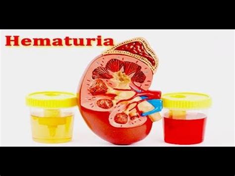 LAMP TCM ACUPUNCTURE 04 Blood And Body Fluids Pathology Qi