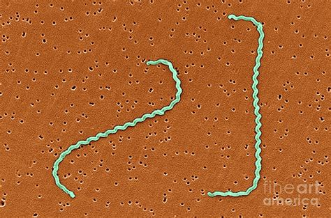 Leptospira Interrogans Photograph By Science Source Fine Art America