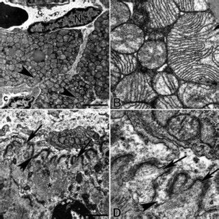 Transmission Electron Photomicrographs Of The Mtj Region Newborn