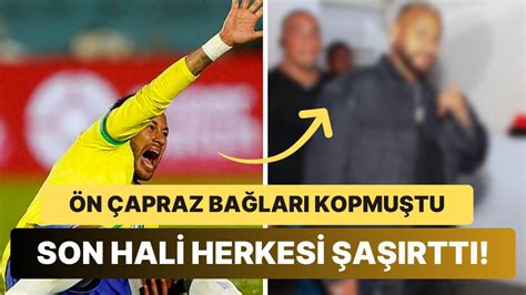 Bu Ne Hal Uzun S Redir Sakatl S Ren Ve Tedavi S Recinde Olan Neymar