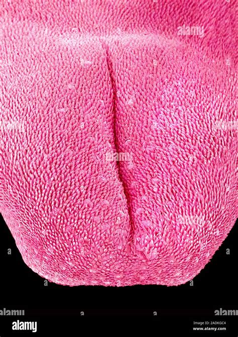 Tongue Of A Mouse Coloured Scanning Electron Micrograph Sem The