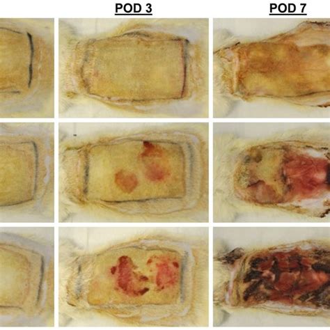 P Aeruginosa Infection Did Not Exacerbate The Neutrophil Response To