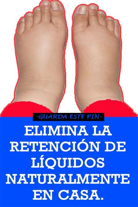 Elimina la Retención de Líquidos naturalmente en casa Remedios para