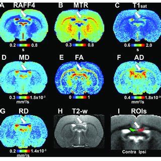 | Quantitative MRI maps in the demyelination phase, on day 3: RAFF4 ...