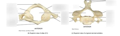 cervical vertebrae (C1) Diagram | Quizlet