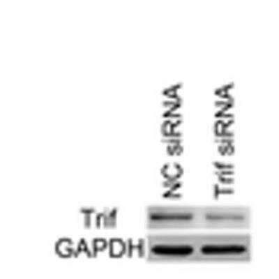 TRIF/TICAM1 Antibody - BSA Free (NB120-13810): Novus Biologicals