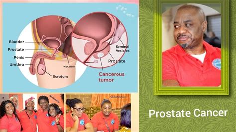 Prostate Cancer Part 1 Twi Akan Language Youtube