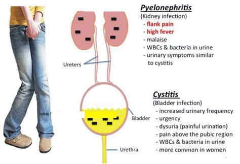 Renal and Urinary Disorders – Practical Nursing Intelligence