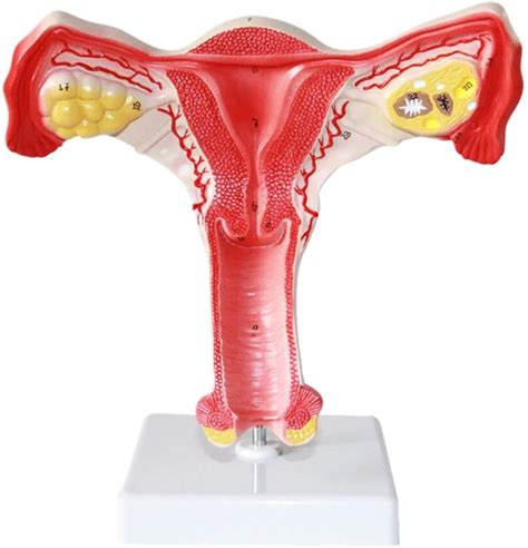 Buy Uterine Lesion Model Human Organ Anatomy Model Female Internal