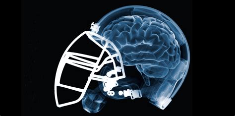 Football Injuries To The Brain At Roderick Howard Blog