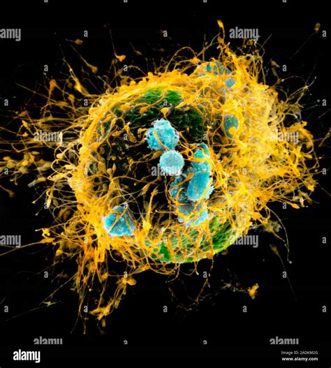 Fertilised egg. Coloured scanning electron micrograph (SEM) of sperm ...