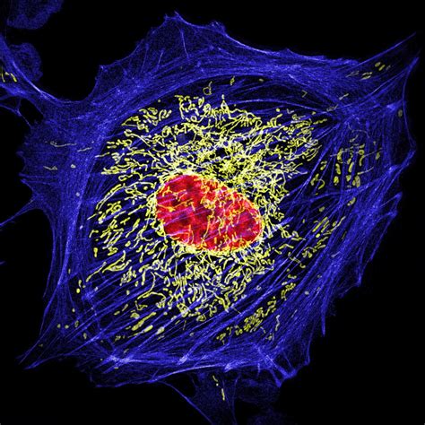 Sim Hms Super Resolution Microscopy In The Department Of Cell Biology At Harvard Medical School