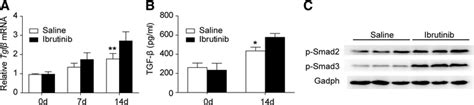 Ibrutinib increased TGF β production in bleomycin induced fibrosis a