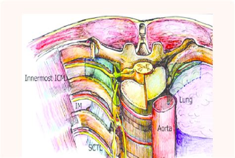 Internal Intercostal